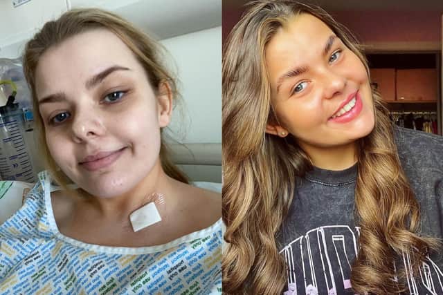 Beth Clyde during her stay at the Queen Elizabeth University Hospital (left) and now (right).