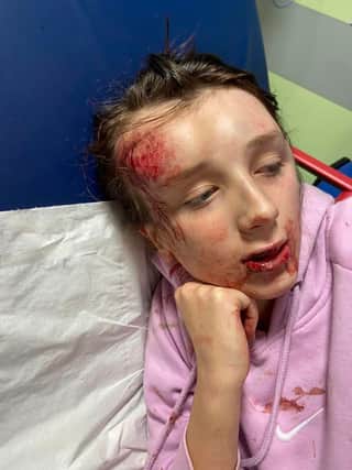 Abbie Jarvis in hospital after being knocked unconscious.