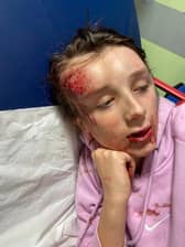 Abbie Jarvis in hospital after being knocked unconscious.  