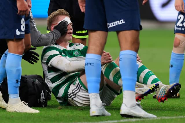 Stephen Welsh of Celtic receives treatment after a head clash against Sydney FC