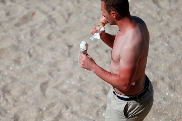 Do you know how to keep your skin safe in the sun (Photo: CHARLY TRIBALLEAU/AFP via Getty Images)