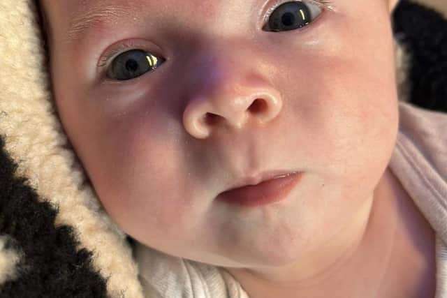Louie was born with an extremely rare genetic condition
