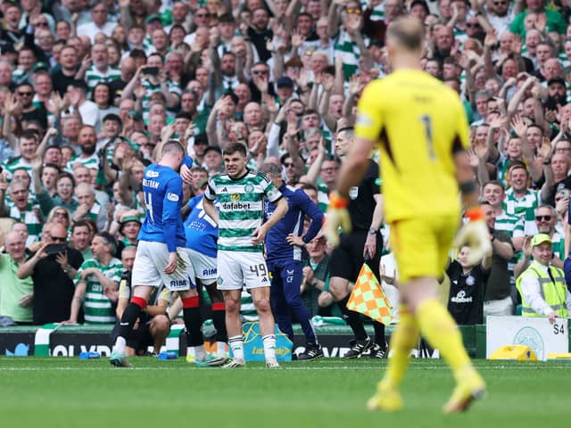 James Forrest of Celtic reacts after John Lundstram is sent off.