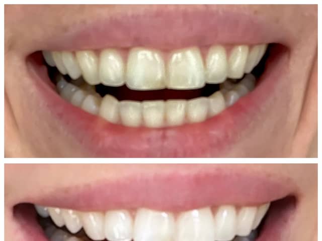 The MySweetSmile brand is one of the top players in this growing market