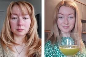 Saffron Mullen, 41, struggled to have intercourse due to a rare anatomical problem causing a blockage in her vagina - which required surgery.