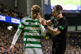 Referee Don Robertson checks on the condition of Celtic midfielder Arne Engels.