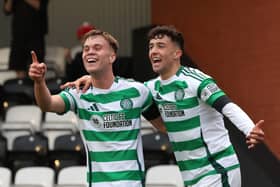 The Celtic talent is wanted by many