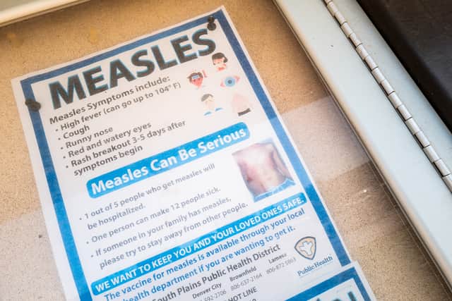 Measles is a highly contagious viral infection.