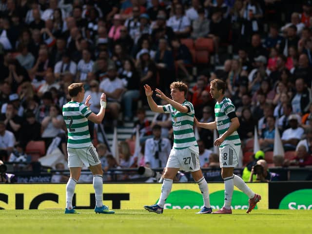 Celtic star suffered injury setback at Hibs.