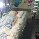 Riley Luke was just eight-years-old when he lost four fingers from his hand following an incident with a firework