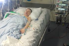 Riley Luke was just eight-years-old when he lost four fingers from his hand following an incident with a firework
