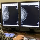Staff who usually work on screening programmes are being freed up to help deal with the coronavirus.