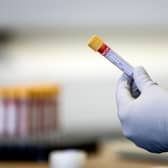 So far, more than 4000 antibody tests have been carried out in Scotland for surveillance purposes. Photo by Simon Dawson - Pool/Getty Images.