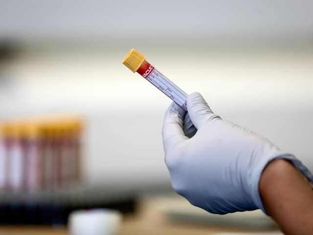 So far, more than 4000 antibody tests have been carried out in Scotland for surveillance purposes. Photo by Simon Dawson - Pool/Getty Images.