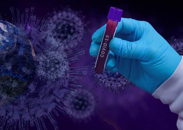 Almost 600 people in Scotland are thought to have caught coronavirus at their place of work but unions claim this is likely just the tip of the iceberg.