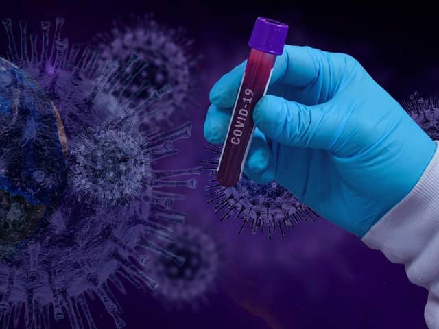 Almost 600 people in Scotland are thought to have caught coronavirus at their place of work but unions claim this is likely just the tip of the iceberg.
