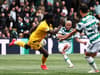 Celtic predicted line-up gallery vs Motherwell - 2 changes with Scott Bain to replace suspended Hart in goals