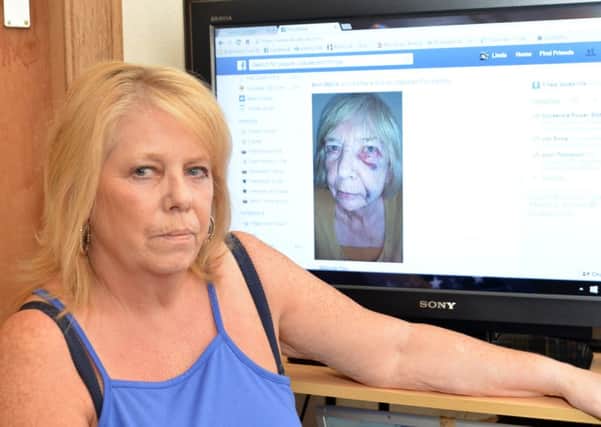 Linda Davidson at home with an online picture of her mother showing the injries she suffered. Pic: George McLuskie