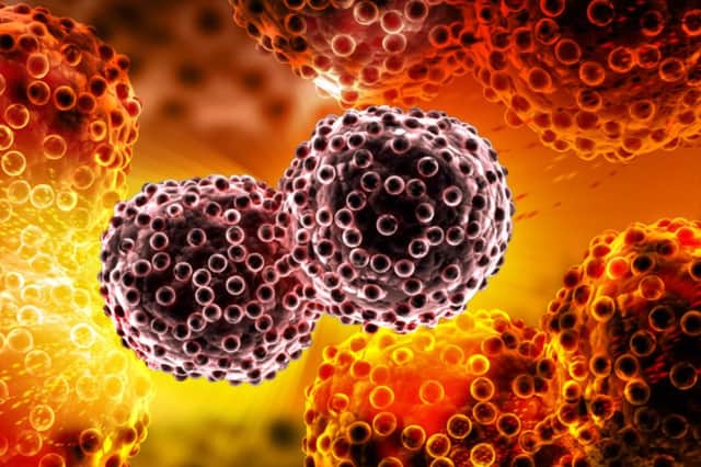 The technique attacks cancer cells, pictured. Credit -Shutterstock
