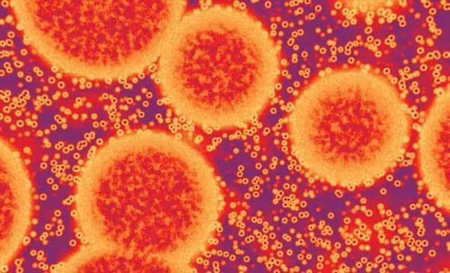 Norovirus bug