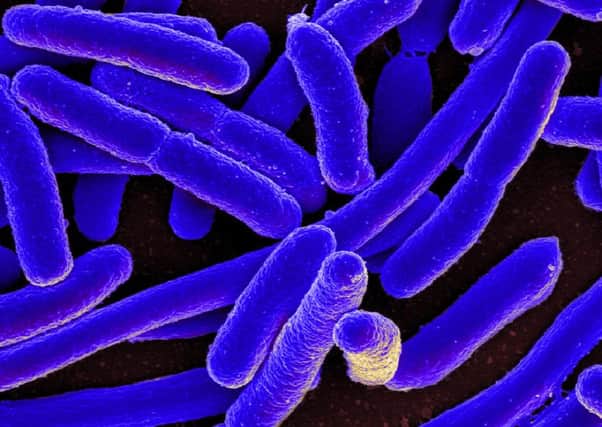 Health Protection Scotland (HPS) is investigating 16 confirmed cases of the same strain of E. coli O157, which may be associated with eating blue cheese made from unpasteurised milk.