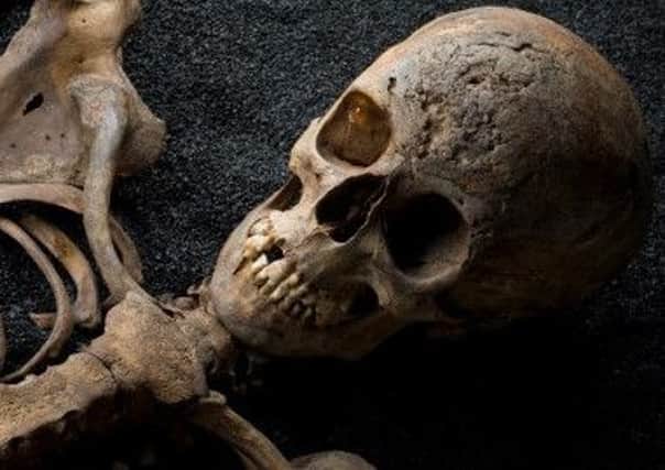 C0046099 Skeletons