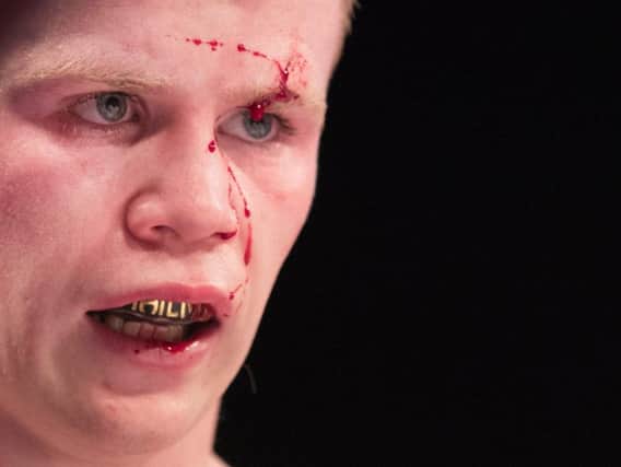 Charlie Flynn sustained a gash above his left eye during fight which ended in draw