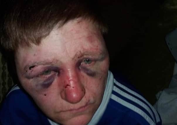 Theresa Campbell was badly beaten
