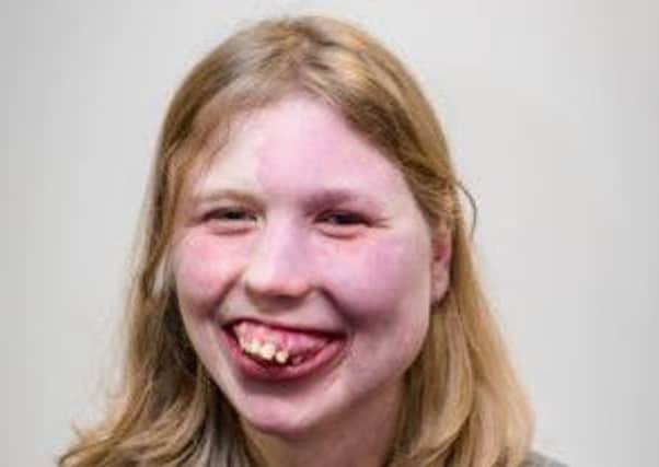 Hannah, Biggar teenager heading up facial diisabilitry charity. Aug 2019